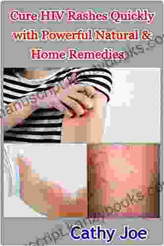 Cure HIV Rashes Quickly With Powerful Natural Home Remedies