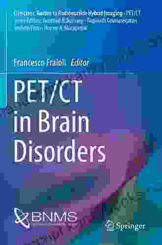 PET/CT In Brain Disorders (Clinicians Guides To Radionuclide Hybrid Imaging)