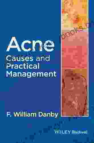 Acne: Causes and Practical Management